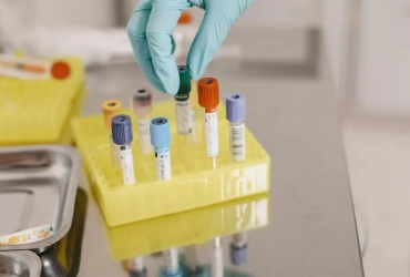 How To Order Peptides?